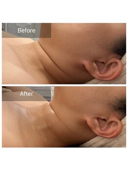 パピヨン(Papillon)/首のシワに◎