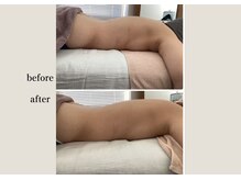 アンドスロウ(&slow)/ゆるかっさ