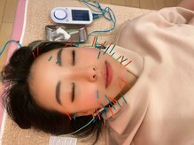 前田鍼灸接骨院