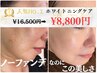 【夏こそシミケア】人気No.1 ホワイトニングケア ¥13,200円→¥8,800円