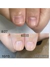 爪育成ネイルケアの変化