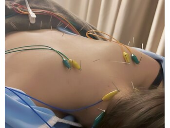 ヴィーライン 恵比寿本院(VeLine)/首肩こり改善の施術の様子