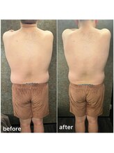 クーレ(CURE)/脂肪燃焼MAXBODY(後ろ)