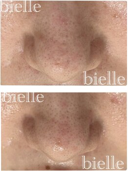 ビエル(Bielle)/毛穴洗浄水で皮脂を浮かせる
