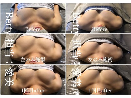 ベティ(Betty)の写真