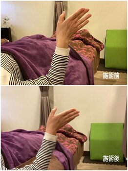 ヴィラ整骨院/手首の痛みや可動域の改善に◎