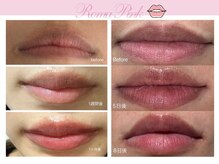 ビューティーリバース 新横浜店/ローマピンク_リップ施術例
