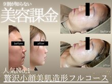 エスポワールカルド(Espoir caldo)