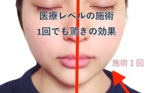 ラ ブリエ(La Briller)