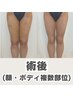 【術後/ボディや顔の複数部位用】ダウンタイム改善、回復促進120分