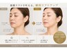 【小顔フェイシャル】筋膜層たるみ小顔改善！！小顔リフトアップフェイシャル