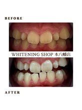 ホワイトニングショップ 千葉店/歯科提携　ホワイトニング専門店