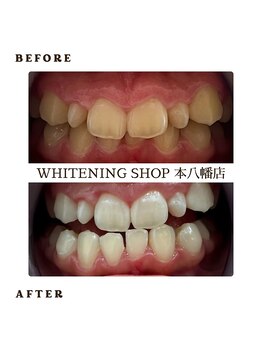 ホワイトニングショップ 千葉店/歯科提携 ホワイトニング専門店