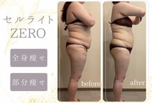 ナチュールファースト(naturel first)
