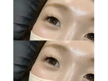 ナイア(nai'a)/フラットマットラッシュ140本