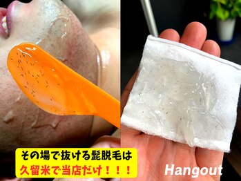 ハングアウト(HANGOUT)/【久留米メンズ脱毛】ヒゲ脱毛