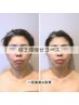 【糸を使わない★リフトUPで極上小顔】高周波＋小顔リンパ＋首肩ほぐし付