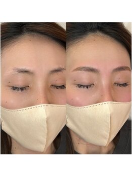 シェリー(Cherie)/ハリウッドブロウリフト