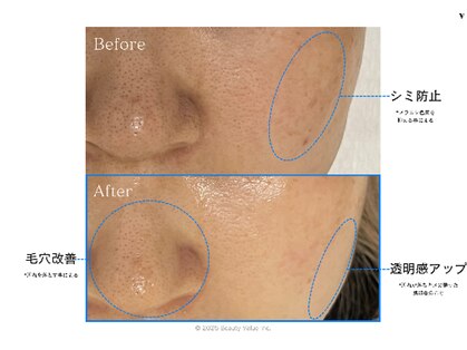 エクラ(eclat)の写真