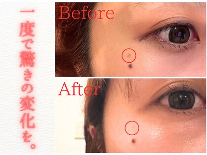 モアビューティーエステ 本通り店(MORE BEAUTY ESTHE)の写真