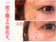 モアビューティーエステ 本通り店(MORE BEAUTY ESTHE)の写真