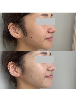 肌ホリック 綾瀬店(肌HOLIC)/復元パック