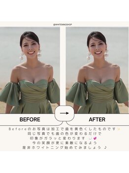 ホワイトニングショップ 葵区静岡駅店/ホワイトニング店ホワイトニング