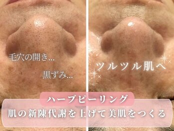 サロン ウーカ(salon WOOCA)/REVI陶肌トリートメント