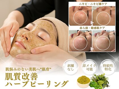 ベストベル(BestBelle)の写真