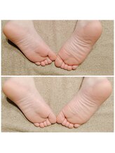 アリアーレ(ALIARE)/骨盤整え【ビフォーアフター】