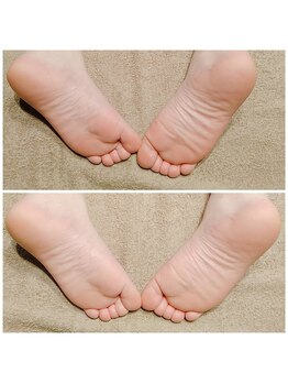 アリアーレ(ALIARE)/骨盤整え【ビフォーアフター】