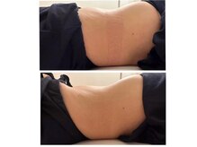 笑うヘソ歌う脳 銀座店/一回目のお客様ビフォーアフター