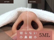 オススメクーポン3【圧倒的人気&即効性】小鼻縮小／クマ取り／瞼の厚みなどのお悩み解消