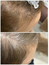 ヒルナム(Heal Nam)/~プロセルセラピーズ~頭皮