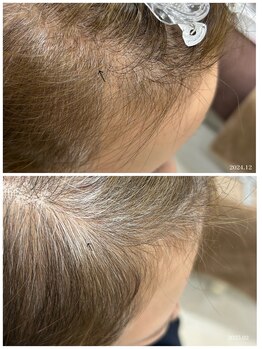 ヒルナム(Heal Nam)/~プロセルセラピーズ~頭皮