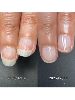 ココ(COCO)/ハンドケア・ネイルケア・自爪