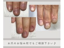 お爪のお悩みに合わせた対応！[池袋/パラジェル/フィルイン]