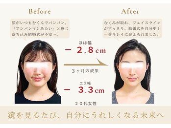 アロハ(ALOHA.)/鏡を見るたびに嬉しくなる未来へ