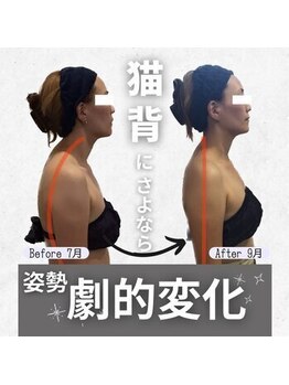 小顔フェイスラボ 春日井店(小顔 Face Labo.)/比較写真