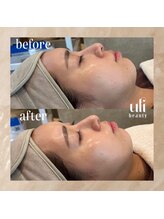 ウリ(uli beauty)/比較写真