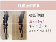 おくや鍼灸院 ママリュクス大阪/初回体験でこんなに姿勢が変わる