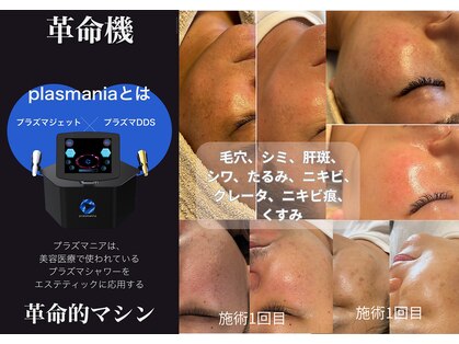 デン(DEN)の写真