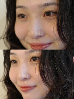 トーチ(Torch)/