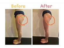 クレビア 麻布十番(CREBIA)/短期間で下半身スッキリ！！