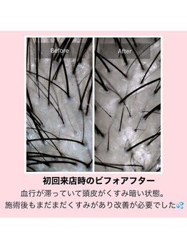 モモ 札幌(MOMO.)/育毛促進スパ