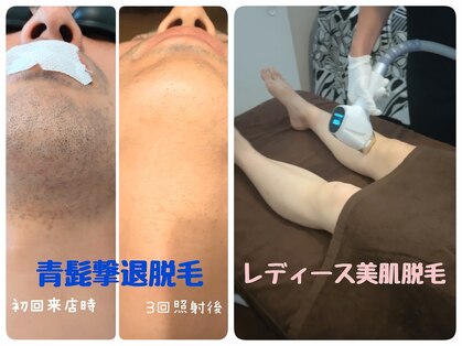 エムブルーム(m-bloom)の写真