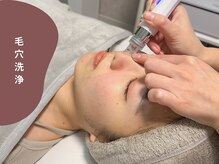 ベル 那覇おもろまち(Belle)/ハーブピーリング｜毛穴洗浄