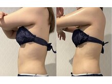 ワイグレイス(Y.GRACE)/ヴィーナスディーバ（4D痩身）