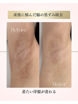 癒える(ielu)/ローマピンク★脇