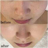 プラセル(Placer)